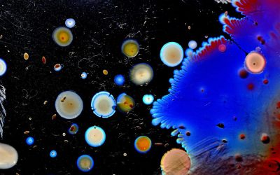 Just Rub Some Dirt on It